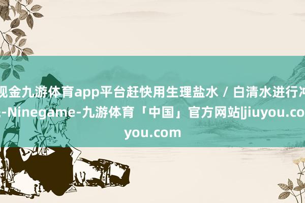 现金九游体育app平台赶快用生理盐水 / 白清水进行冲洗-Ninegame-九游体育「中国」官方网站|jiuyou.com